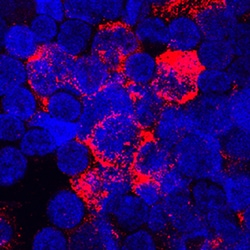 Human TSG-6 Antibody, R D Systems 25&mu;g; Unlabeled:Antibodies, Polyclonal