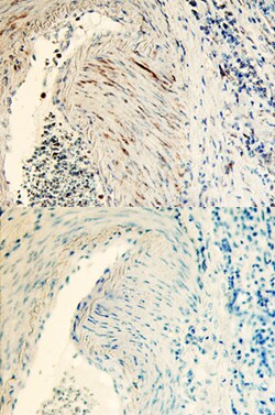 Human Tsukushi/TSK Antibody, R D Systems 25 &mu;g | Buy Online | R&D Systems | Fisher Scientific