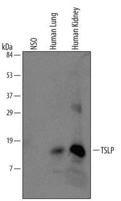 Human TSLP Antibody, R D Systems 100ug; Unlabeled:Antibodies, Monoclonal