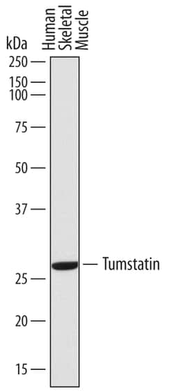 Human Tumstatin Antibody, R D Systems 25&mu;g; Unlabeled:Antibodies, Monoclonal
