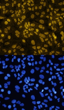 Human Twist-1 Antibody, R D Systems 100&mu;g; Unlabeled:Antibodies, Polyclonal
