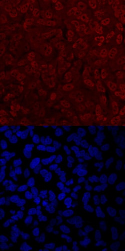 Human Twist-2 Antibody, R D Systems 25&mu;g; Unlabeled:Antibodies, Polyclonal