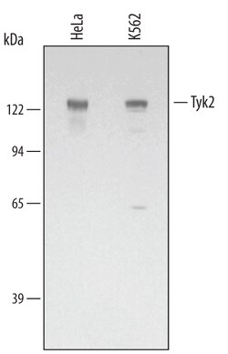 Human Tyk2 Antibody, R D Systems 100ug; Unlabeled:Antibodies, Monoclonal