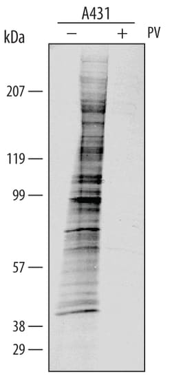 Phospho-Tyrosine Alkaline Phosphatase-conjugated Antibody, R D Systems