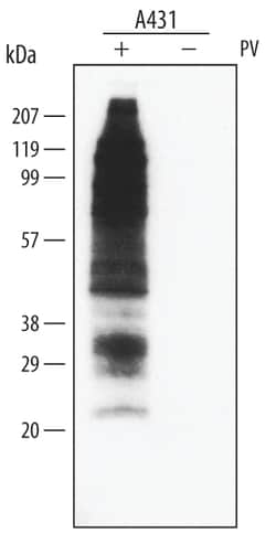 Phospho-Tyrosine HRP-conjugated Antibody, R D Systems 100uL; HRP:Antibodies,