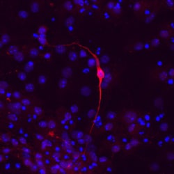Human/Mouse/Rat Tyrosine Hydroxylase Antibody, R D Systems 100&mu;g; Unlabeled:Antibodies,