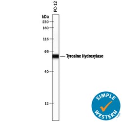 Human/Mouse/Rat Tyrosine Hydroxylase Antibody, R D Systems 100&mu;g; Unlabeled:Antibodies,