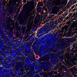 Human/Mouse Tyrosine Hydroxylase Antibody, R D Systems 25&mu;g; Unlabeled:Antibodies,