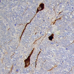 Human/Mouse Tyrosine Hydroxylase Antibody, R D Systems 25&mu;g; Unlabeled:Antibodies,