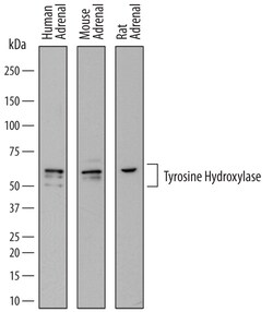 Human/Mouse Tyrosine Hydroxylase Antibody, R D Systems 25&mu;g; Unlabeled:Antibodies,