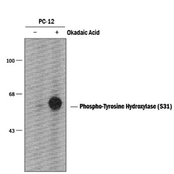 Mouse/Rat/Primate Phospho-Tyrosine Hydroxylase (S31) Antibody, R D Systems
