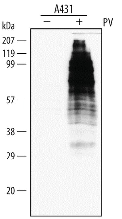 Phospho-Tyrosine Antibody, R D Systems 25&mu;g; Unlabeled:Antibodies, Monoclonal