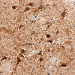 Human/Mouse UBE2K/E2-25K Antibody, R D Systems 100ug; Unlabeled:Antibodies,