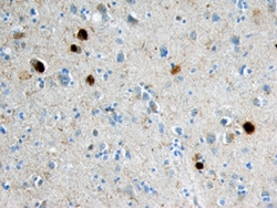 Human Ubiquitin/Ubiquitin+1 Antibody, R D Systems 100ug; Unlabeled:Antibodies,