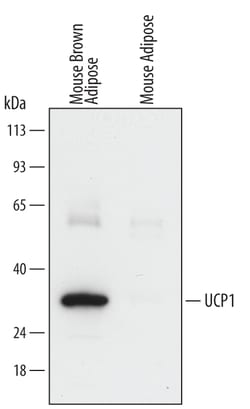 Human/Mouse UCP1 Antibody, R D Systems 100ug; Unlabeled:Antibodies, Monoclonal