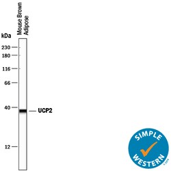 Human/Mouse UCP2 Antibody, R D Systems 100&mu;g; Unlabeled:Antibodies,