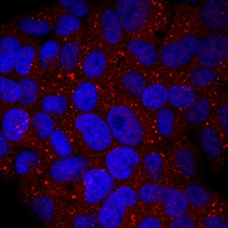 Human Glucuronosyltransferase 1A1/UGT1A1 Antibody, R D Systems 100&mu;g;