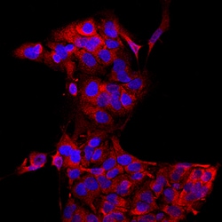 Human Glucuronosyltransferase 1A1/UGT1A1 Antibody, R D Systems 100ug; Unlabeled:Antikörper