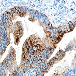 Human ULBP-4/RAET1E Antibody, R D Systems 100ug; Unlabeled:Antibodies,