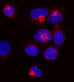 Human UNC13D Alternative Isoform Antibody, R D Systems 25 &mu;g | Buy Online | R&D Systems | Fisher Scientific