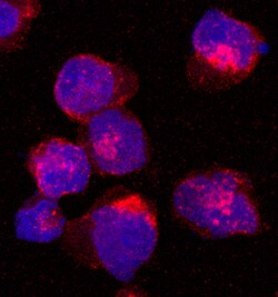 Human UNC13D Antibody, R D Systems 25&mu;g; Unlabeled:Antibodies, Monoclonal