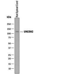 Rat UNC5H2/UNC5B Antibody, R D Systems 100&mu;g; Unlabeled:Antibodies,