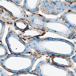 Mouse uPAR Antibody, R D Systems 100&mu;g; Unlabeled:Antibodies, Polyclonal