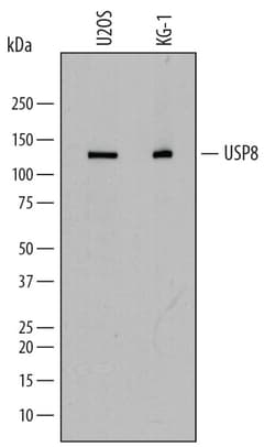 Human USP8 Antibody, R D Systems 100&mu;g; Unlabeled:Antibodies, Polyclonal