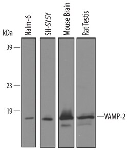 Human/Mouse/Rat VAMP-2 Antibody, R D Systems 25 &mu;g | Buy Online | R&D Systems | Fisher Scientific