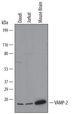 Human/Mouse VAMP-2 Antibody, R D Systems 100 &mu;g | Buy Online | R&D Systems | Fisher Scientific