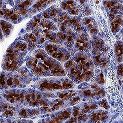 Human VAMP-8 Antibody, R D Systems 25&mu;g; Unlabeled:Antibodies, Polyclonal