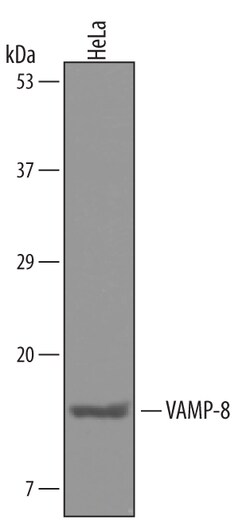 Human VAMP-8 Antibody, R D Systems 25&mu;g; Unlabeled:Antibodies, Polyclonal