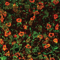 Rat Vanilloid R1/TRPV1 Antibody, R D Systems 25&mu;g; Unlabeled:Antibodies,