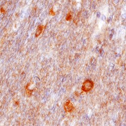 Human VAP-B Antibody, R D Systems 100&mu;g; Unlabeled:Antibodies, Polyclonal