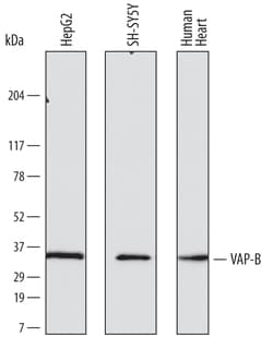 Human VAP-B Antibody, R D Systems 100ug; Unlabeled:Antibodies, Monoclonal