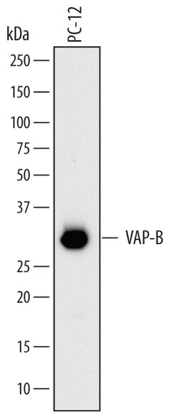 Rat VAP-B Antibody, R D Systems 100ug; Unlabeled:Antibodies, Monoclonal