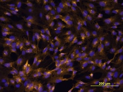 Human VCAM-1/CD106 Antibody, R D Systems:Antibodies:Primary Antibodies