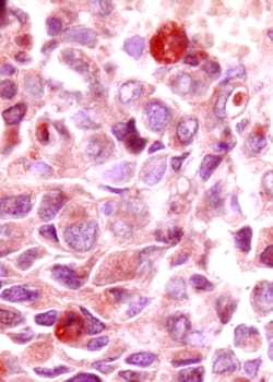Human VEGF165 Antibody, R D Systems 1mg; Unlabeled:Antibodies, Polyclonal