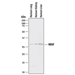 Human VEGF165 Antibody, R D Systems 25 &mu;g | Buy Online | R&D Systems | Fisher Scientific