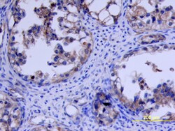 Human VEGFR1/Flt-1 Antibody, R D Systems 100&mu;g; Unlabeled:Antibodies,