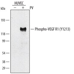Human Phospho-VEGFR1/Flt-1 (Y1213) Antibody, R D Systems 100&mu;g; Unlabeled:Antibodies,