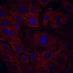 Human VEGFR3/Flt-4 Antibody, R D Systems 500&mu;g:Antibodies, Monoclonal