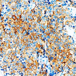 Human/Mouse VEGF-B167/186 Antibody, R D Systems 500&mu;g; Unlabeled:Antibodies,