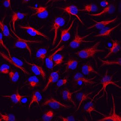 Human/Mouse/Rat Vimentin Antibody, R D Systems 25 &mu;g | Buy Online | R&D Systems | Fisher Scientific