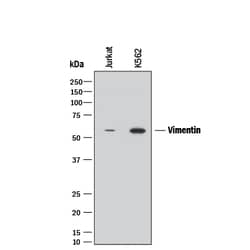 Human/Mouse/Rat Vimentin Antibody, R D Systems 25 &mu;g | Buy Online | R&D Systems | Fisher Scientific