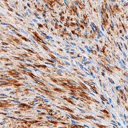 Human/Rat Vinculin Antibody, R D Systems 25&mu;g; Unlabeled:Antibodies,