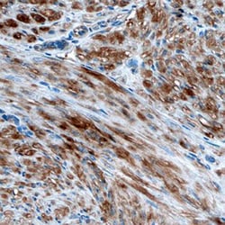 Human/Mouse/Rat Vinculin Antibody, R D Systems 100ug; Unlabeled:Antibodies,