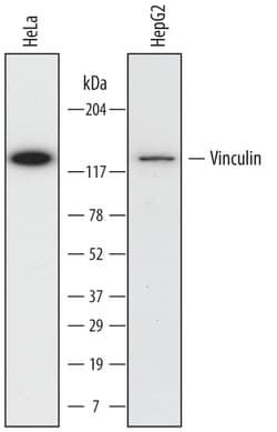 Human/Mouse/Rat Vinculin Antibody, R D Systems 100ug; Unlabeled:Antibodies,