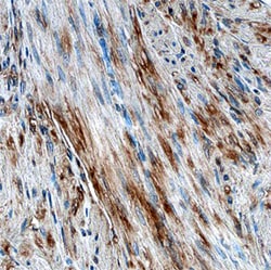 Human/Mouse/Rat Vinculin Antibody, R D Systems 100 &mu;g | Buy Online | R&D Systems | Fisher Scientific