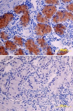 Human VIP Antibody, R D Systems 100ug; Unlabeled:Antibodies, Monoclonal